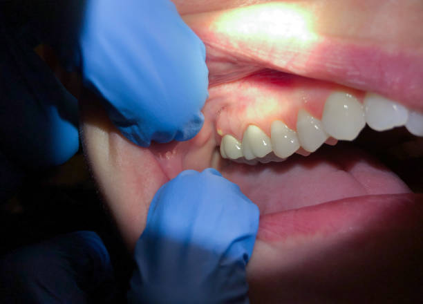 Best Weekend Emergency Dentist in Buffalo, OK